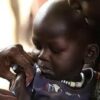 سودان : تزايد حالات الإصابة بالحصبة و الدعوة إلى إطلاق حمالات التطعيم