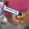 فرنسا تسجل أول إصابة بـ’إيبولا’ لطبيب عائد من الكونغو الديمقراطية